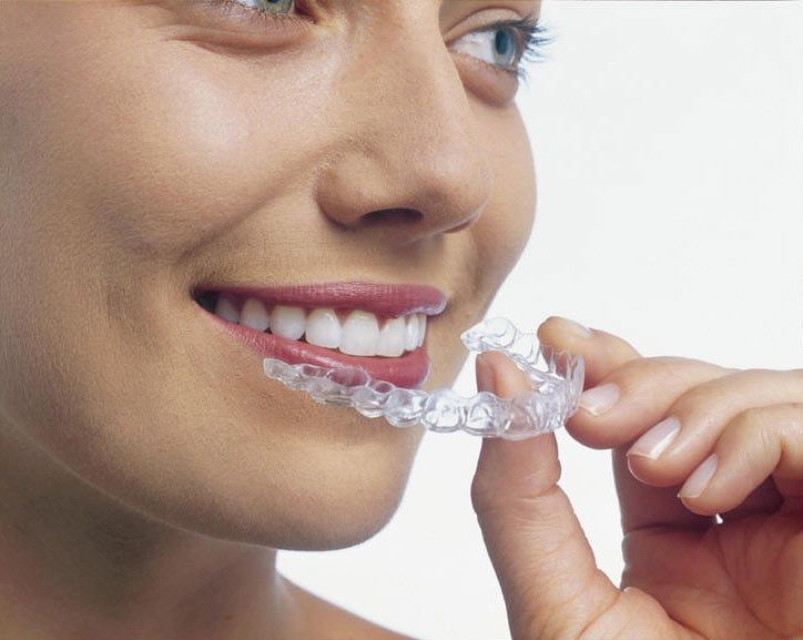 Invisalign® — Concord's Choice for Invisalign® — Dr. Fink Concord, CA